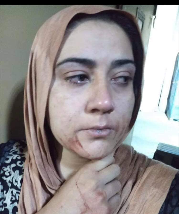 رفتار وحشیانه و غیرقانونی پلیس با نامزدان معترض پارلمان - تصویر دوم خبر