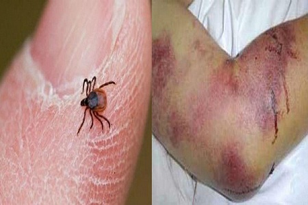 اطلاعیه وزارت زراعت درباره جلوگیری از مبتلا شدن به تب کنگو - خبرگزاری افغان ایرکا