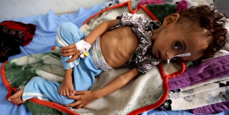 هشدار سازمان ملل درباره آغاز «شمارش معکوس تا فاجعه در یمن» - خبرگزاری افغان ایرکا