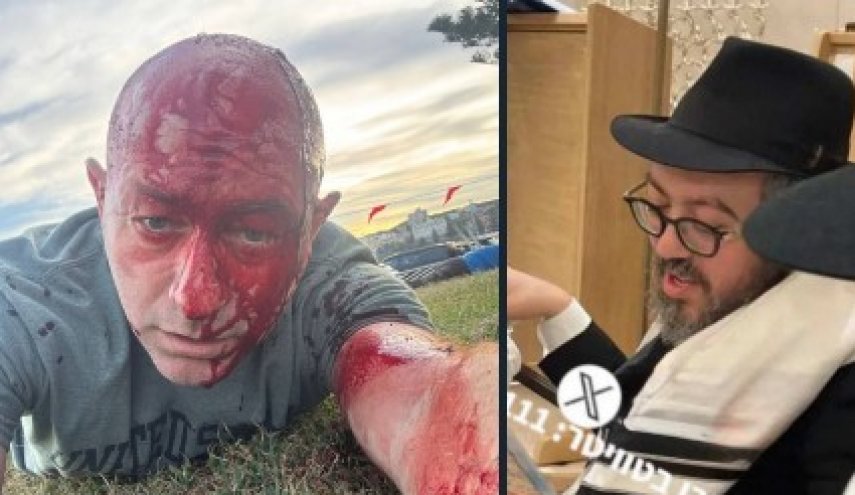 کشته شدن خاخام اسرائیلی در «حنوکای خونین» و زخمی شدن رئیس شورای یهودیان استرالیا-«اسرائیل» کشته شدن خاخام اسرائیلی در «حنوکای خونین» و زخمی شدن رئیس شورای یهودیان استرالیا-«اسرائیل»