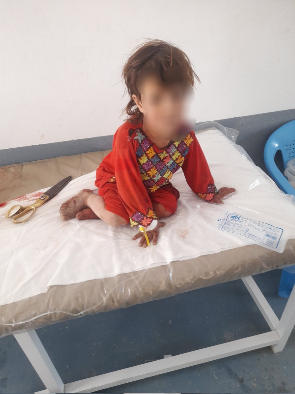 انفجار سرگلوله راکت در هلمند؛ 5 کودک جان باختند - تصویر سوم خبر