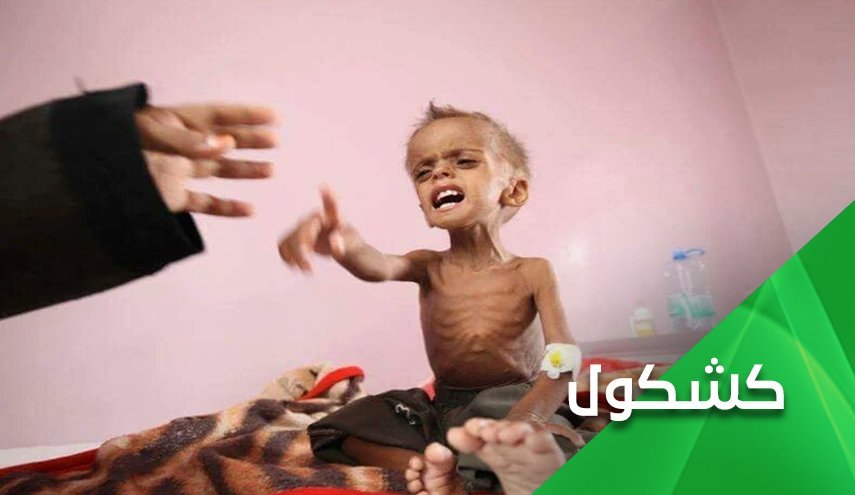  تبانی دبیرکل سازمان ملل؛ تبرئه بن سلمان از کودک کشی در یمن  - خبرگزاری افغان ایرکا