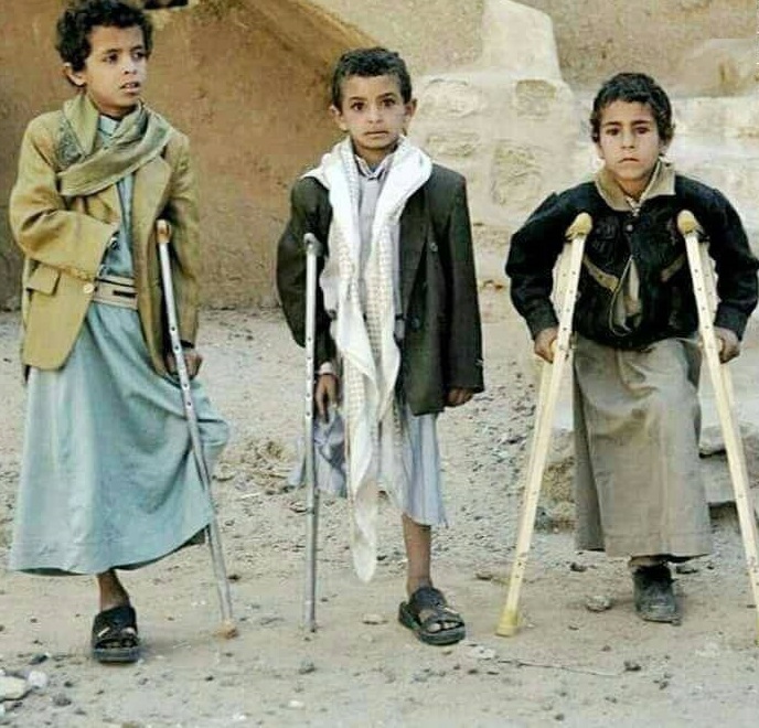  تصویری متاثرکننده از سه کودک یمنی با سه پا!  - تصویر دوم خبر