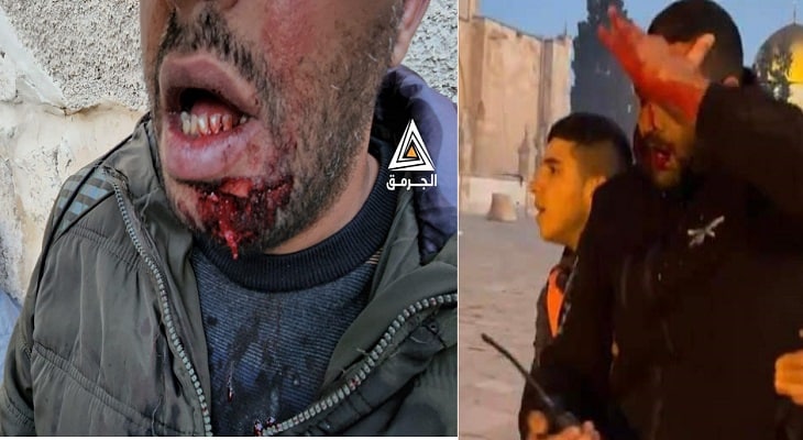 ‏طالبان حمله رژیم صهیونیستی بر نمازگزاران فلسطینی مسجد الاقصی را شدیدأ محکوم کردند - خبرگزاری افغان ایرکا