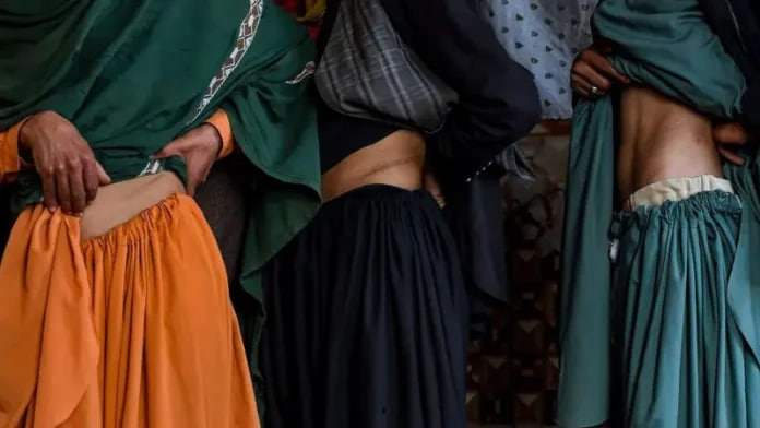 پیوند کلیه در افغانستان ممنوع شد؛ دو بیمار فوت کردند - خبرگزاری افغان ایرکا