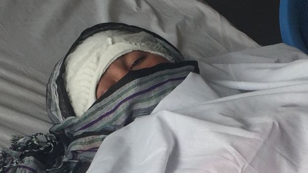 زرینه: شوهرم گفت گوشهایت را می برم تا دیگر نتوانی ازدواج کنی - تصویر دوم خبر