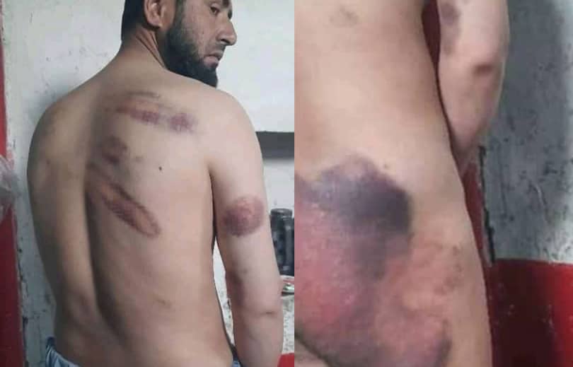 لت وکوب و شکنجه یک مرد در بدخشان - خبرگزاری افغان ایرکا