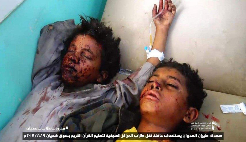  شمار کودکان شهید یمنی از 3000 نفر فراتر رفت  - خبرگزاری افغان ایرکا