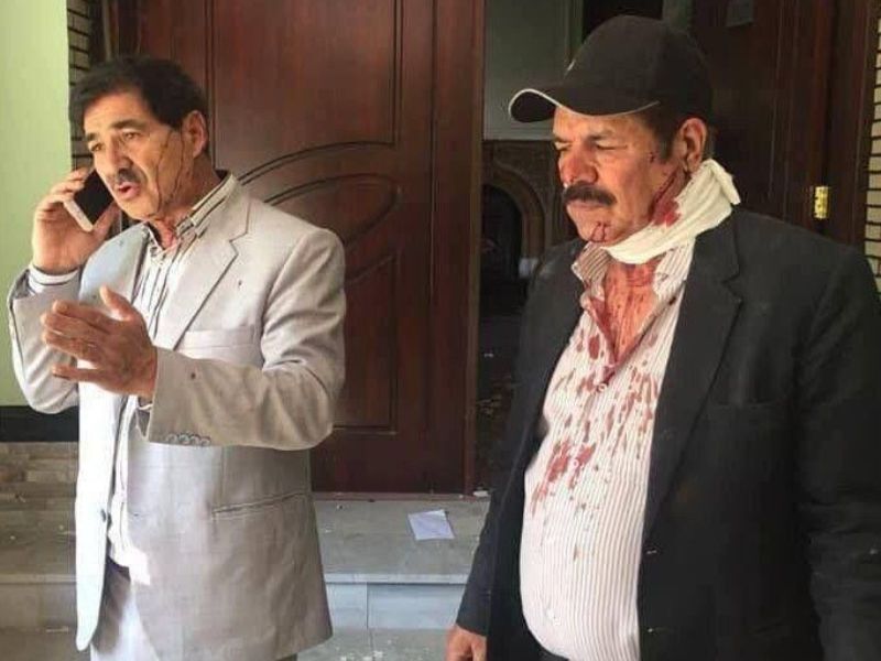 زخمی شدن رئیس فدراسیون فوتبال کشور در حمله انتحاری کابل - خبرگزاری افغان ایرکا
