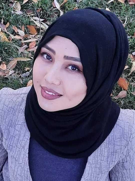 دختر جوانی که در انفجاری در کابل پاهایش را از دست داده بود، در شفاخانه ی ایمرجنسی جان باخت  - تصویر دوم خبر