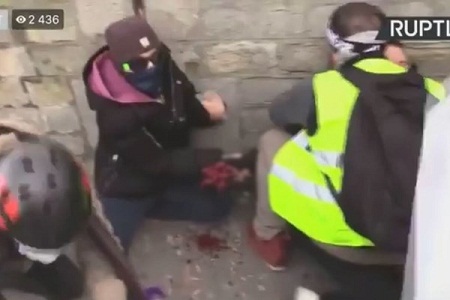بر اثر انفجار نارنجک پلیس دست معترض فرانسوی قطع شد - خبرگزاری افغان ایرکا