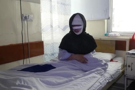 یک مرد پس از لت وکوب همسرش بر روی او تیزاب پاشید - خبرگزاری افغان ایرکا
