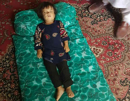 گلثوم؛ دختری به جرم نرفتن به آغوش پدر کشته شد - خبرگزاری افغان ایرکا