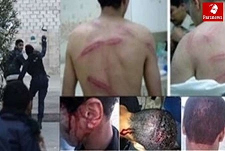 تجاوز جنسی؛ یکی از انواع روش های شکنجه ی آل خلیفه علیه شهروندان بحرینی - خبرگزاری افغان ایرکا