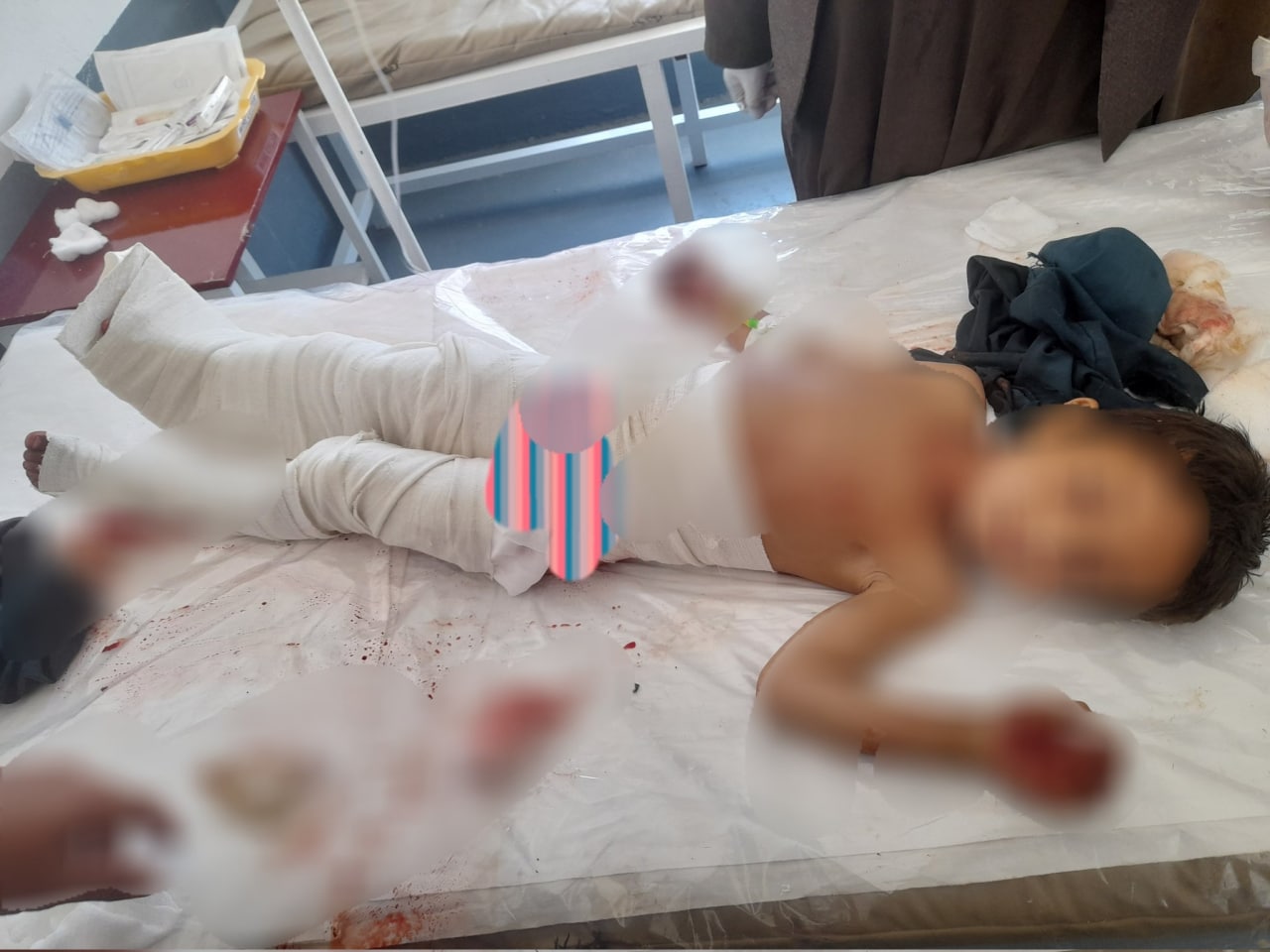 انفجار سرگلوله راکت در هلمند؛ 5 کودک جان باختند - خبرگزاری افغان ایرکا