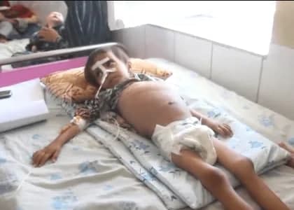  شیوع بیماری گلودردی ساری و کشنده در جوزجان - خبرگزاری افغان ایرکا