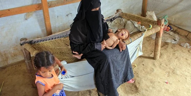 سازمان ملل: یک میلیون زن باردار یمنی در خطر سوءتغذیه شدید قرار دارند - خبرگزاری افغان ایرکا
