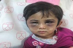 کودک آزاری دلخراش یک کودک افغانستانی در اصفهان ایران - خبرگزاری افغان ایرکا