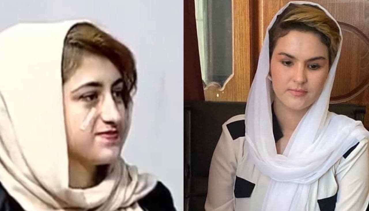  نگرانی سازمان ملل از ناپدید شدن دو فعال زن در کابل - خبرگزاری افغان ایرکا