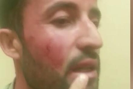  متهم شدن یک فرماندۀ قول اردوی 209 شاهین به بدرفتاری با زیردستانش  - خبرگزاری افغان ایرکا