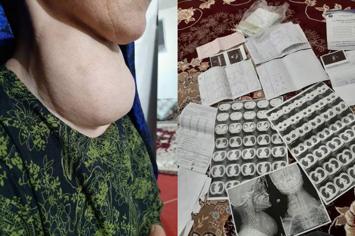 اقدام خداپسندانه یک پزشک متخصص افغانستانی برای درمان رایگان یک بانوی هم وطن در تهران - خبرگزاری افغان ایرکا