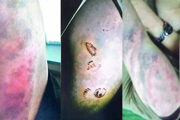 تجاوز گروهی طالبان به زن عضو ارتش سابق - خبرگزاری افغان ایرکا