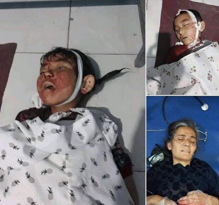 زنک خطر برای بیماران و پرسنل شفاخانه 100 بستر دشت برچی - خبرگزاری افغان ایرکا