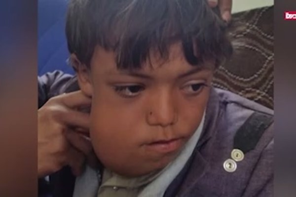 افزایش ابتلای کودکان یمنی به سرطان در نتیجه سلاح های ممنوعه متجاوزان - تصویر سوم خبر