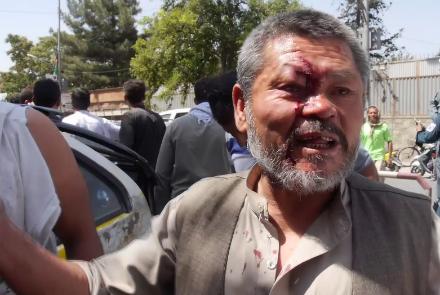  لوی سارنوالی: عاملان لت و کوب عوض محمد بازداشت شوند  - خبرگزاری افغان ایرکا