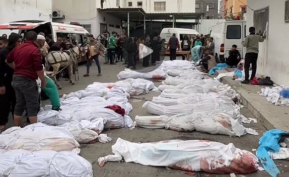 جنایت صهیونیست ها در غزه ادامه دارد؛ گوشه ای از جنایت رژیم صهونیستی در بیمارستان عدوان 